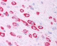 NB100-905 - HIF1A / HIF1 alpha