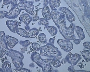 NB100-905 - HIF1A / HIF1 alpha