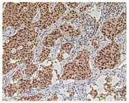 NB100-917 - Aurora kinase A