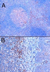 NB100-1226 - TRIM5 / RNF88
