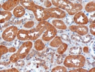 NB100-1405 - USH1C / Harmonin