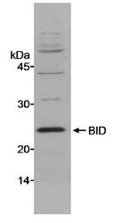 NB100-952 - BID