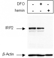 NB100-1798 - IREB2