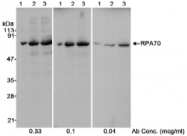NB100-2204 - RPA1