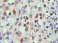 NB100-2176 - RELA / NF-kB p65