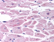 NB100-122 - HIF2A / HIF2 alpha