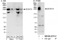 NB100-2275 - ZC3H13