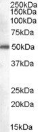 NB100-2818 - DDX6