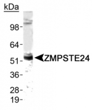 NB100-2387 - ZMPSTE24