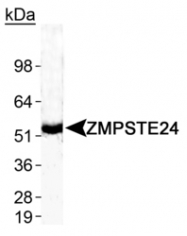 NB100-2388 - ZMPSTE24
