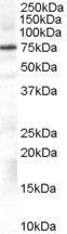 NB100-2831 - Beta-ARK-1 / ADRBK1