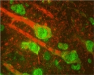 NB300-156 - Beta-ARK-1 / ADRBK1