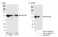 NB110-40586 - HNRNPUL1 / E1BAP5