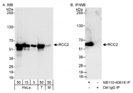 NB110-40618 - RCC2