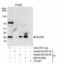 NB110-40681 - BCAS2 / DAM1