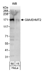 NB100-40825 - BAT8