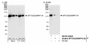 NB100-40849 - U5-116 kDa / EFTUD2
