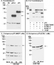 NB100-420 - Tumor protein p73 (TP73)
