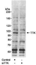 NB100-462 - TTK