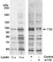 NB100-463 - TTK
