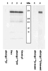 NSB526 - EIF4G1 / EIF4F