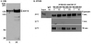 NB600-264 - Bcl-11B