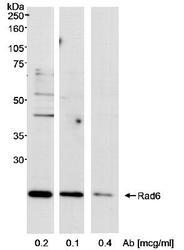 NB100-555 - UBE2A / RAD6A
