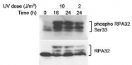 NB100-544 - RPA2
