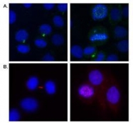 NB500-185 - Aurora kinase B