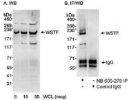 NB600-279 - BAZ1B / WSTF