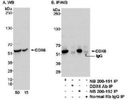 NB200-191 - DDX6