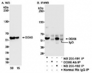 NB200-192 - DDX6