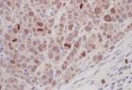 NB100-294 - Aurora kinase B