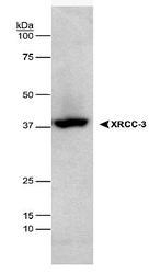 NB100-180 - XRCC3