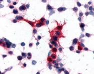 NLS179 - Nicotinic acid receptor 2