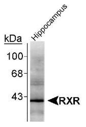 NB300-311 - RAR-beta / RARB