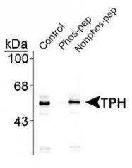 NB300-307 - Tryptophan 5-hydroxylase 1 (TPH1)