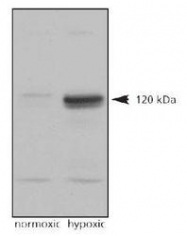 NB100-122 - HIF2A / HIF2 alpha
