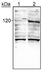 NB100-132 - HIF2A / HIF2 alpha