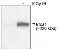 NB100-200 - BRCA1 / RNF53