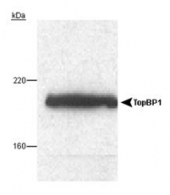 NB100-217 - TOPBP1