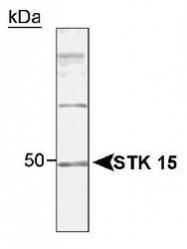 NB100-267 - Aurora kinase A