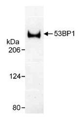 NB100-305 - TP53BP1