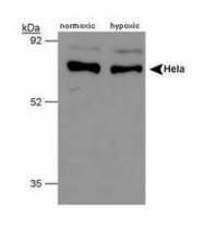 NB100-295 - P4HTM / PH4