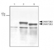 NB100-266 - DNMT3B