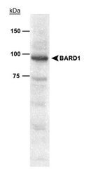NB100-319 - BARD1