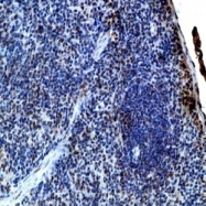 NB100-736 - Interleukin-21 / IL21