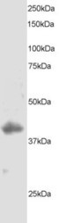 NB100-834 - DUSP1 / MKP1