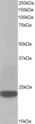 NB600-507 - Transgelin (TAGLN)