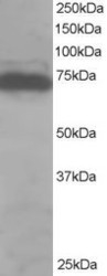 NB100-1410 - DDX5